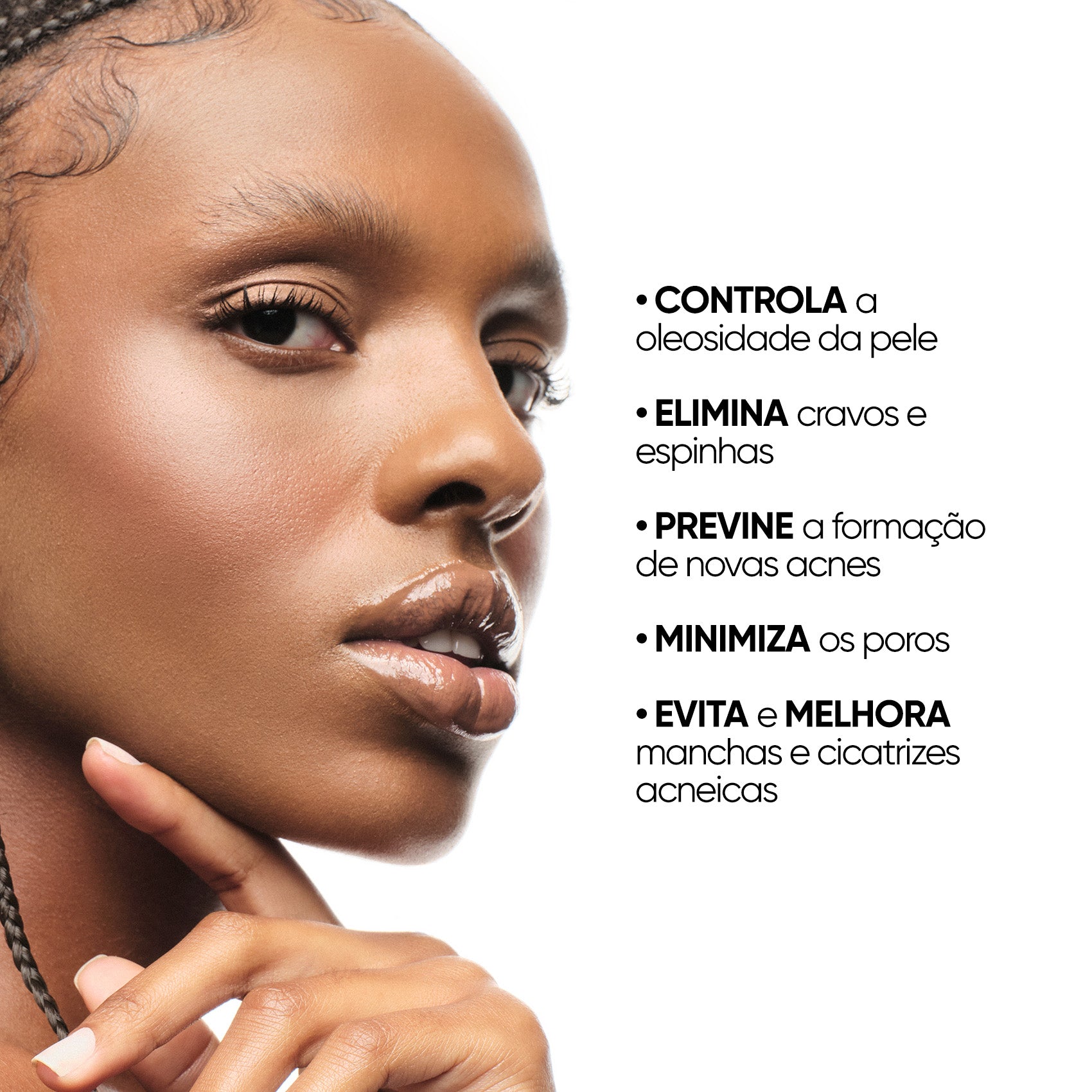 Sérum facial antiacne e oleosidade 10% ácido glicólico + 0,5% ácido salicílico.